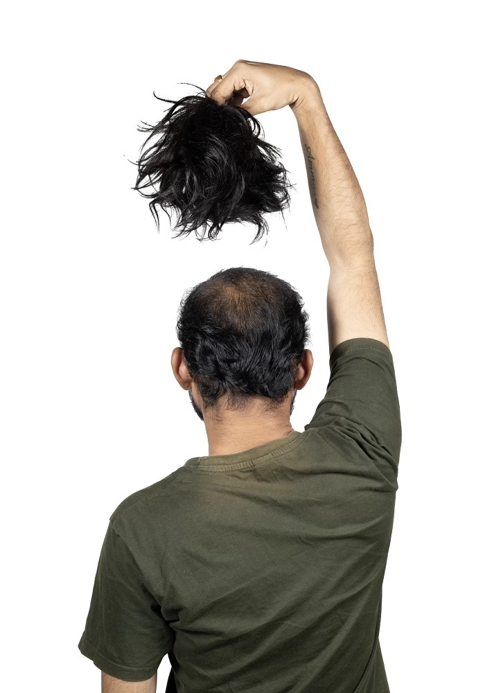 Hair Patch Manufacturer & Wholesaler